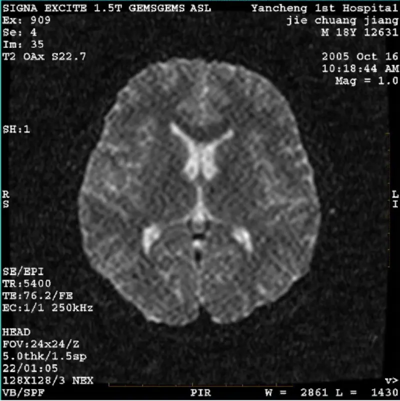 ARTIFACT WI/Fiesta-afbeelding Witte pixel