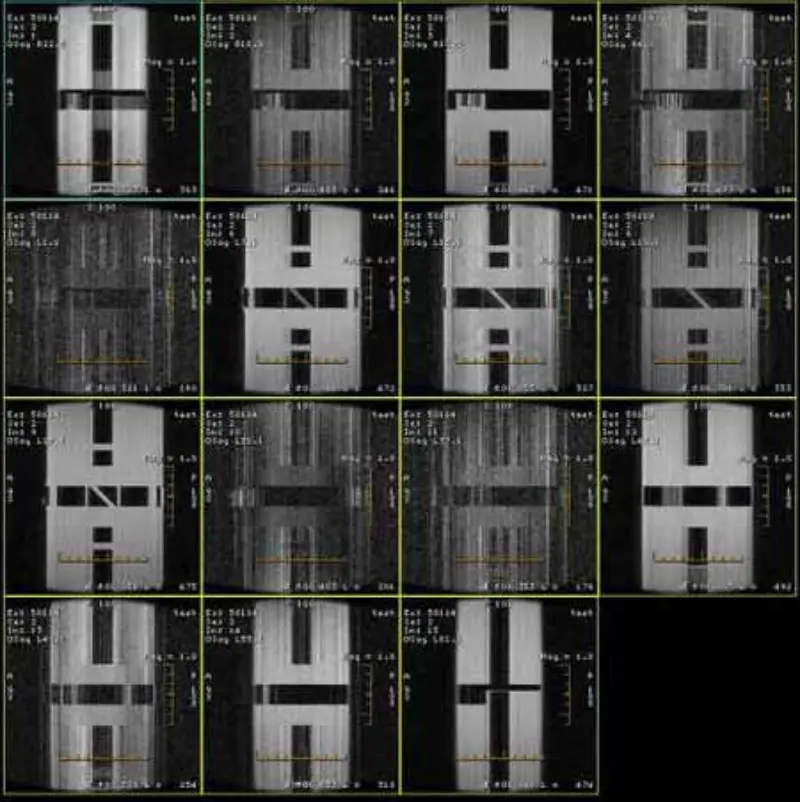 FSE- en GRE-artefact